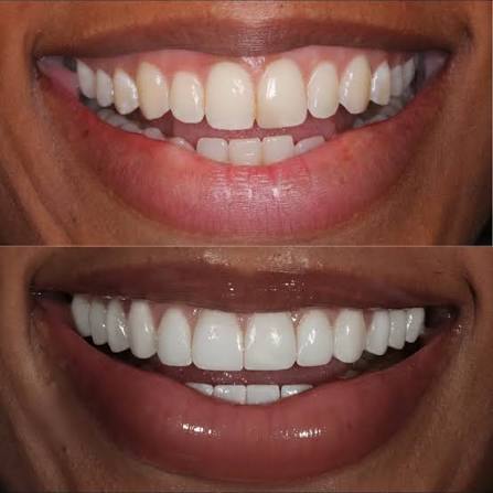 Dental slide 1