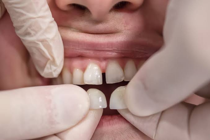 Cosmetic Dentistry